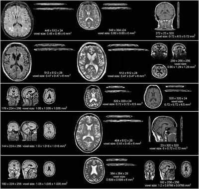 Deep attention super-resolution of brain magnetic resonance images acquired under clinical protocols